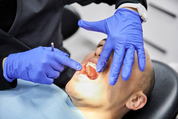 Best Dental Abscess Treatment in Great Falls Crossing, VA