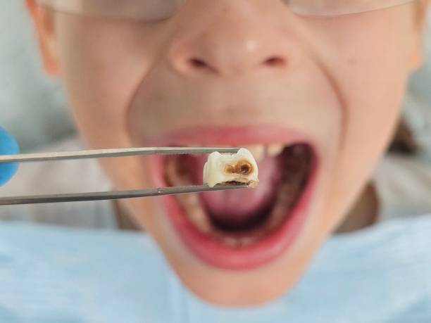 Best Emergency Care for Gum Disease in Great Falls Crossing, VA
